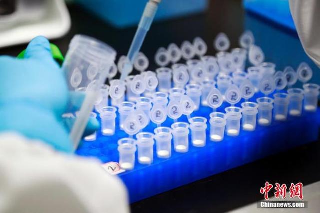 全球新冠确诊病例超1300万 专家:美疫情未有结束迹象